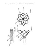 CLOT CAPTURE SYSTEMS AND ASSOCIATED METHODS diagram and image