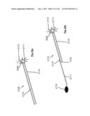 CLOT CAPTURE SYSTEMS AND ASSOCIATED METHODS diagram and image