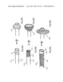 CLOT CAPTURE SYSTEMS AND ASSOCIATED METHODS diagram and image