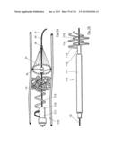 CLOT CAPTURE SYSTEMS AND ASSOCIATED METHODS diagram and image