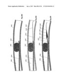 CLOT CAPTURE SYSTEMS AND ASSOCIATED METHODS diagram and image