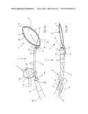 CLOT CAPTURE SYSTEMS AND ASSOCIATED METHODS diagram and image