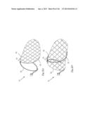 CLOT CAPTURE SYSTEMS AND ASSOCIATED METHODS diagram and image