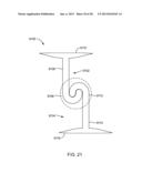 Sacroiliac Fusion Cage diagram and image