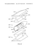 Sacroiliac Fusion Cage diagram and image