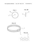 ENDOLUMINAL DEVICE AND METHOD diagram and image