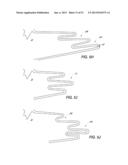 ENDOLUMINAL DEVICE AND METHOD diagram and image