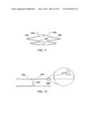 ENDOLUMINAL DEVICE AND METHOD diagram and image