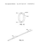 ENDOLUMINAL DEVICE AND METHOD diagram and image