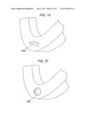 ENDOLUMINAL DEVICE AND METHOD diagram and image