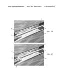 ENDOLUMINAL DEVICE AND METHOD diagram and image