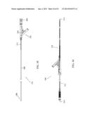 ENDOLUMINAL DEVICE AND METHOD diagram and image