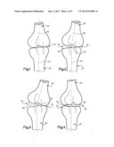 JOINT SPACER diagram and image