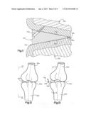 JOINT SPACER diagram and image