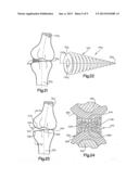 JOINT SPACER diagram and image