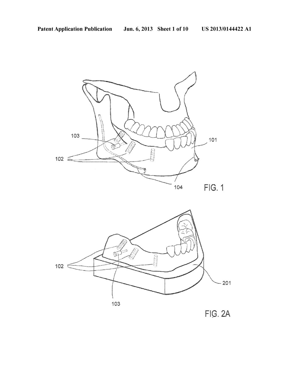 Method and System for Generating a Dental Implant Surgical Drill Guide - diagram, schematic, and image 02