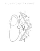 Full Suspension Footwear diagram and image