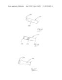 APPARATUS AND METHOD FOR IMPROVED ASSISTED VENTILATION diagram and image