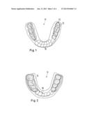 DENTAL SPLINT MADE OF TWO PLASTICS WITH DIFFERENT DEGREES OF HARDNESS diagram and image