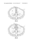 Methods for Unconventional Gas Reservoir Stimulation With Stress Unloading     For Enhancing Fracture Network Connectivity diagram and image