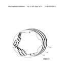 Electrical Rotary Machine Assembly With Stator Core Sections diagram and image