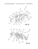 Spacer For Supporting Conductors In An Electric Machine diagram and image