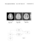 ENDOGENOUS MAGNETIZATION CONTRAST IN MRI diagram and image