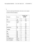 ROLE OF FRAGILE X MENTAL RETARDATION GENE AND PROTEIN IN CANCER METASTASIS diagram and image