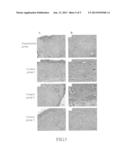 BIOCELLULOSE DRESSING AND METHOD FOR PREPARING THE SAME diagram and image