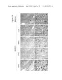 BARD1 Isoforms in Lung and Colorectal Cancer and Use Thereof diagram and image