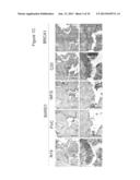 BARD1 Isoforms in Lung and Colorectal Cancer and Use Thereof diagram and image