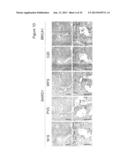 BARD1 Isoforms in Lung and Colorectal Cancer and Use Thereof diagram and image