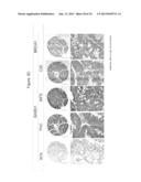 BARD1 Isoforms in Lung and Colorectal Cancer and Use Thereof diagram and image