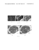 ESTABLISHMENT OF RHESUS MONKEY MODEL OF AUTOIMMUNITY TYPE 1 DIABETES diagram and image