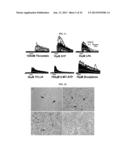 METHOD FOR TREATMENT OF BRAIN CANCERS diagram and image