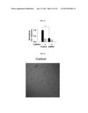 METHOD FOR TREATMENT OF BRAIN CANCERS diagram and image