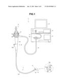 ENDOSCOPE diagram and image