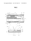 ENDOSCOPE diagram and image