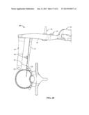 SURGICAL ACCESS SYSTEM AND RELATED METHODS diagram and image