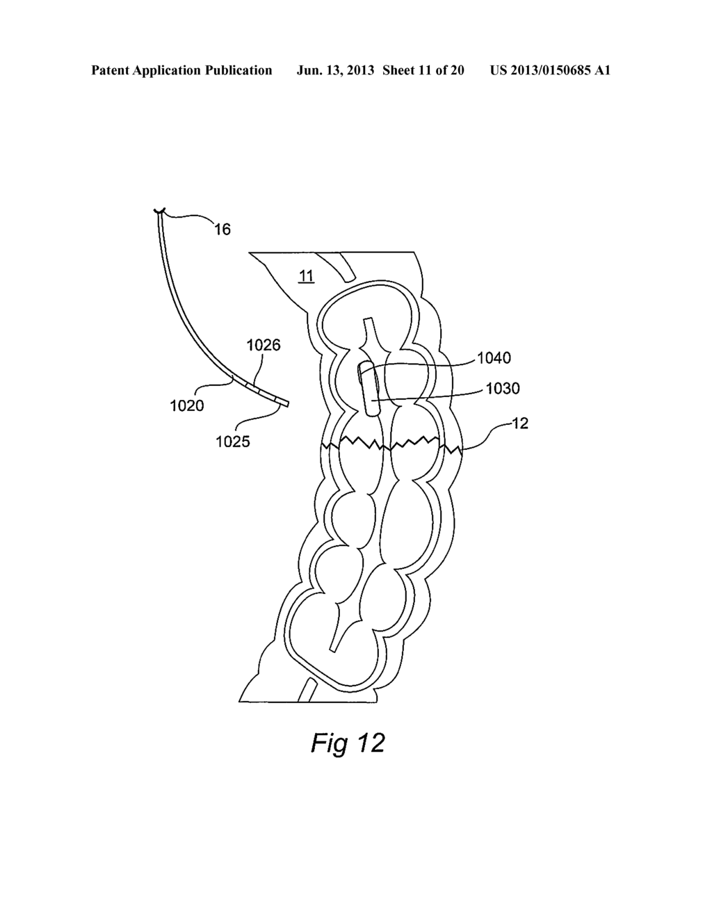 SYSTEM AND METHOD FOR MONITORING A SURGICAL SITE - diagram, schematic, and image 12