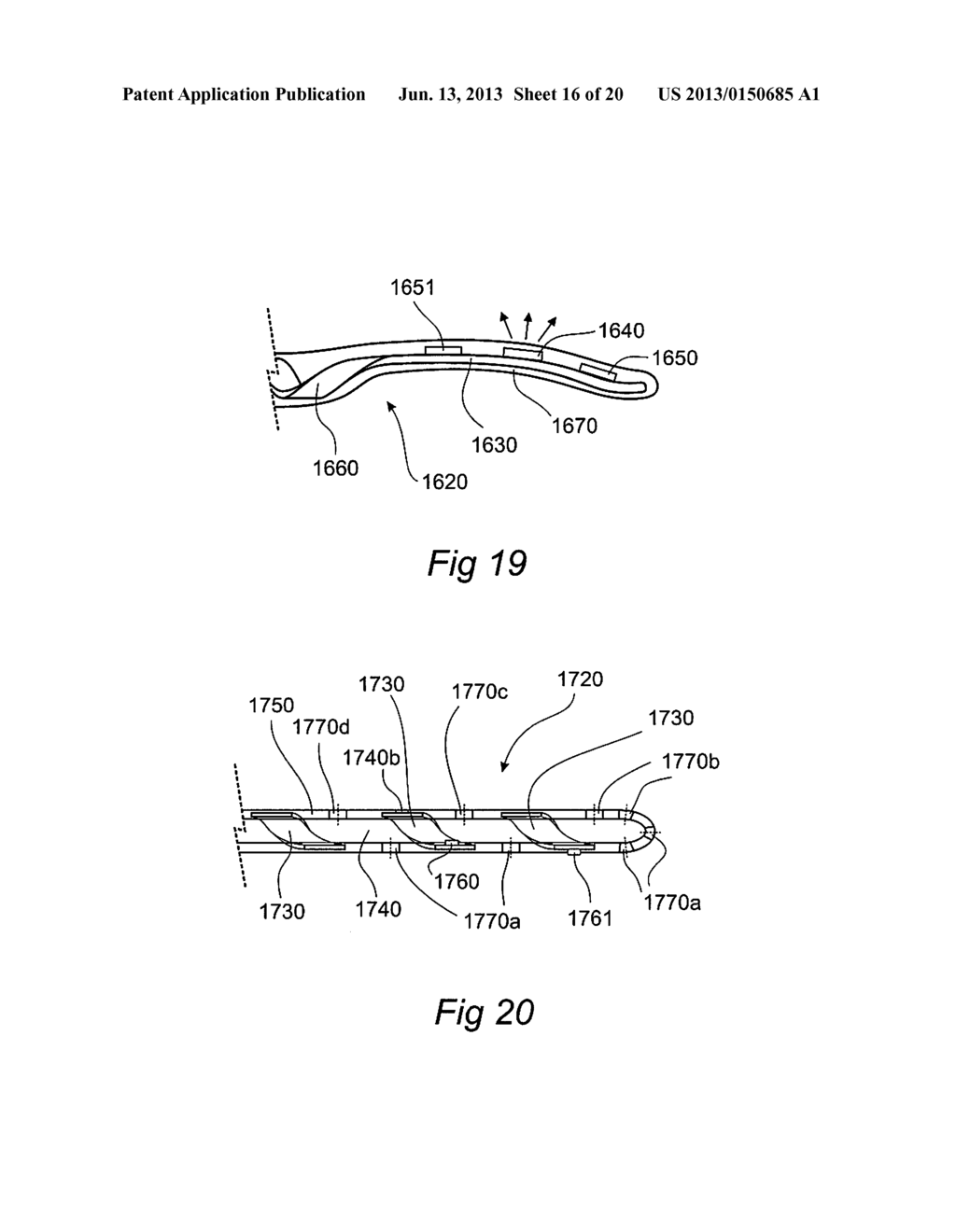 SYSTEM AND METHOD FOR MONITORING A SURGICAL SITE - diagram, schematic, and image 17