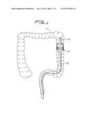 SURGICAL TISSUE MONITORING SYSTEM diagram and image