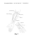 BLOOD VESSEL ACCESS DEVICES, SYSTEMS, AND METHODS diagram and image