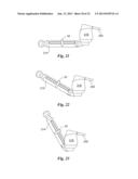 BLOOD VESSEL ACCESS DEVICES, SYSTEMS, AND METHODS diagram and image