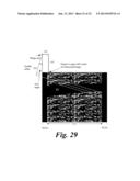 BLOOD VESSEL ACCESS DEVICES, SYSTEMS, AND METHODS diagram and image