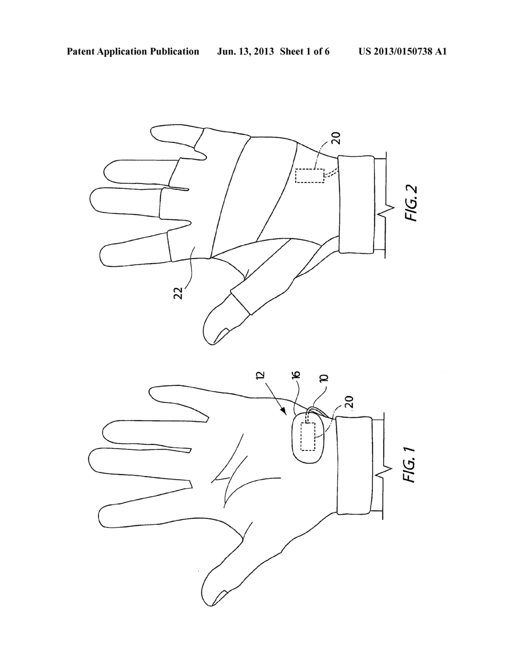 HYPOTHENAR SENSOR - diagram, schematic, and image 02