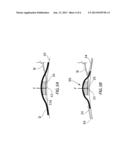 HYPOTHENAR SENSOR diagram and image