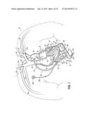 BY-PASS SHUNT TO REDUCE FLOW OUTPUT OF CIRCULATORY ASSIST DEVICE diagram and image