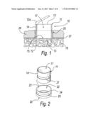 TREATMENT TIP INCISION TEMPLATE diagram and image