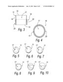 TREATMENT TIP INCISION TEMPLATE diagram and image